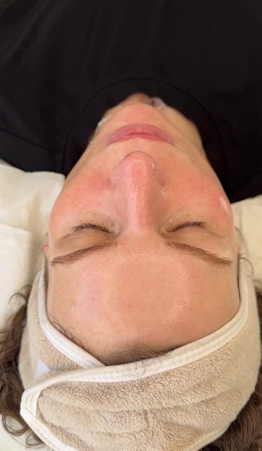 Natural lip enhancement